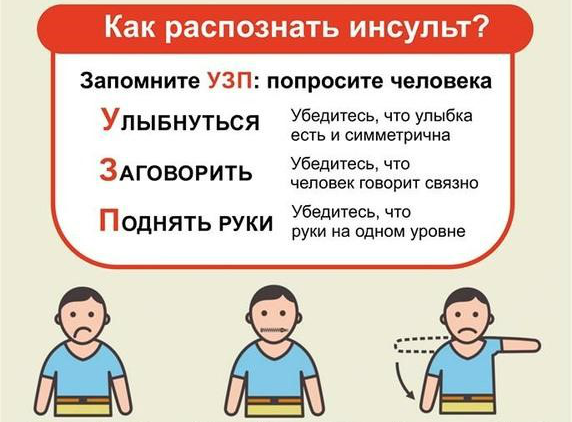 Признаки инсульта