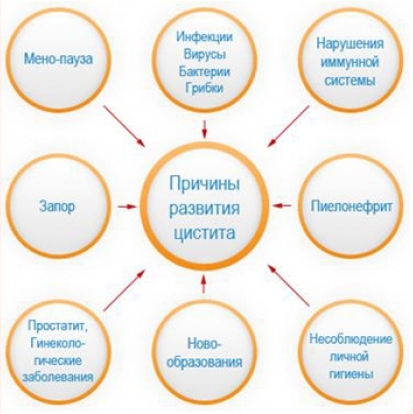 Причины цистита. Список факторов, провоцирующих цистит.
