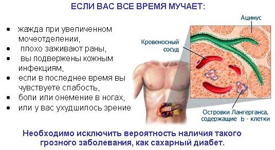 Сахарный диабет.