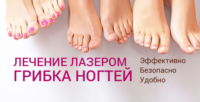 Лечение грибка ногтей лазером