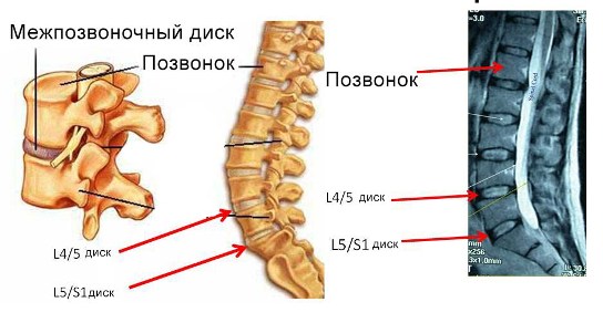 Неврологи исследуют пояснично-крестцовый отдел позвоночника.